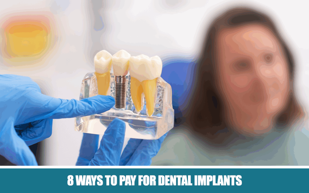 Dental implants in Ontario