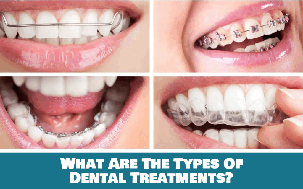 Types Of Dental Treatments