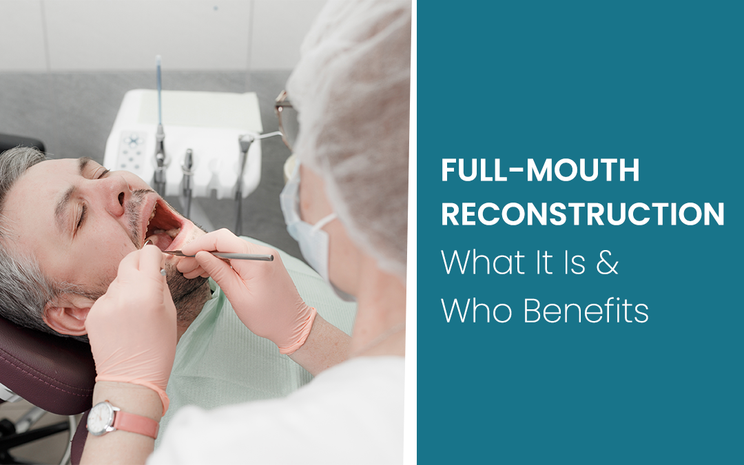 Teeth bleaching in Ontario