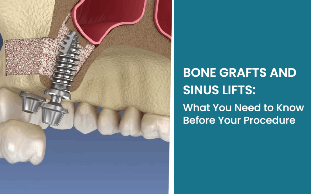 Dental implants in Ontario