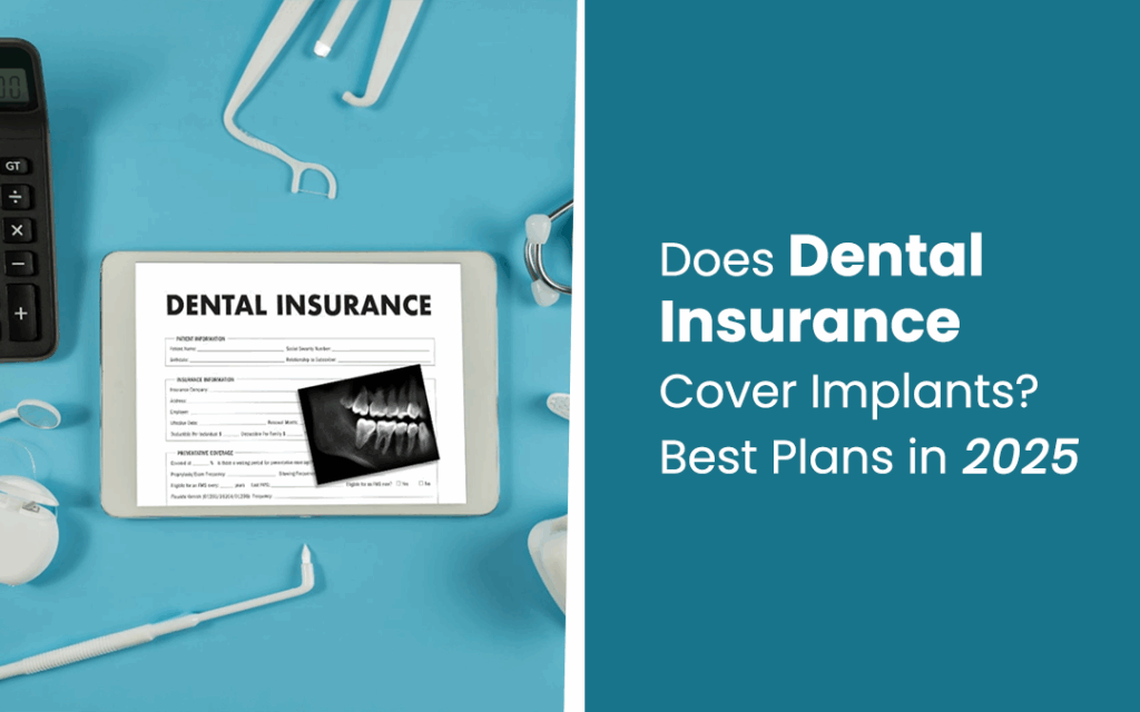 Dental implants in Ontario